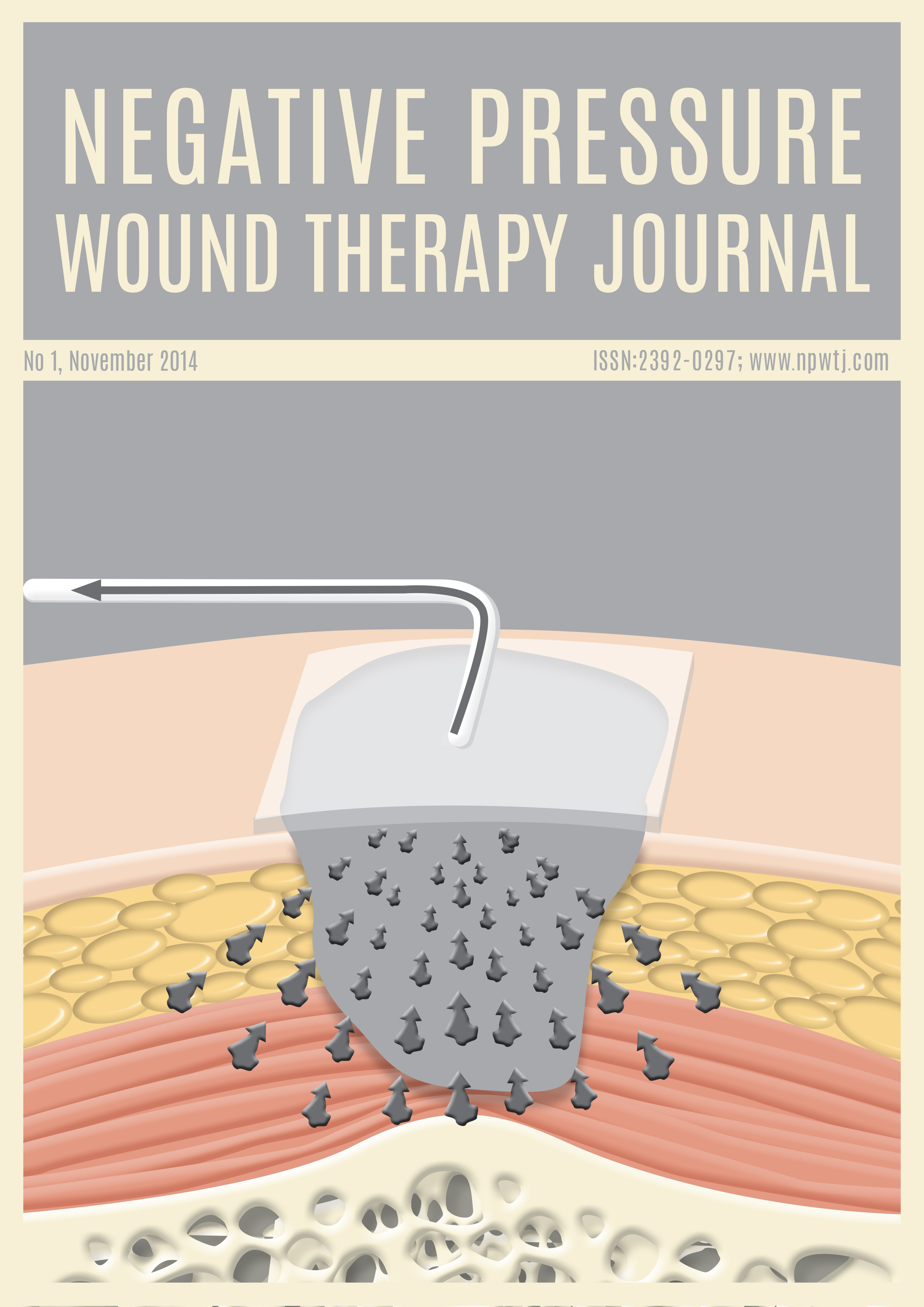 Negative Pressure Wound Therapy